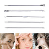 Stainless Steel Blackhead Extractors (Set of 5)